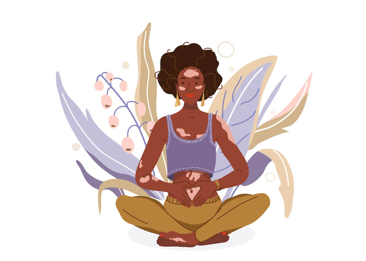 Love yourself with problem vitiligo skin vector background. Self-care body wellness concept. African woman sitting in yoga posture. Girl fold her hands on her stomach, fingers formed heart shape